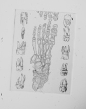 human leg bones etching by Tiina Lilja